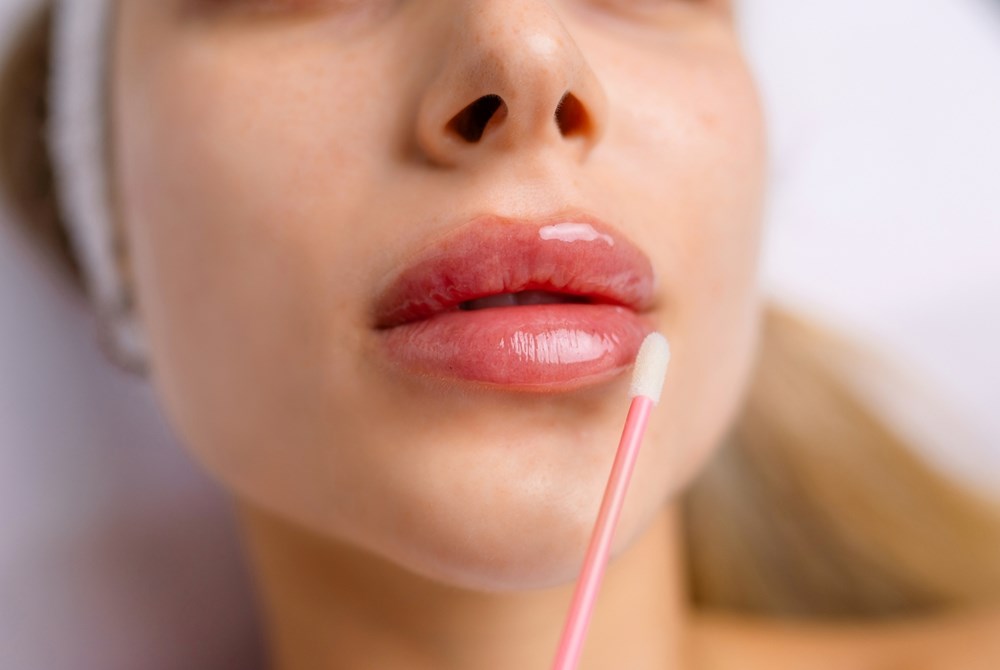 فيلر الشفاه لأول مرة؟ ..  كل ما تحتاجين إلى معرفته قبل الجلسة